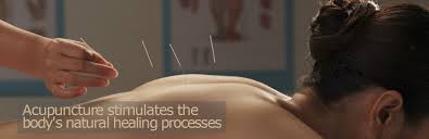 Acupuncture: Tapping into the Body’s Healing Pathways